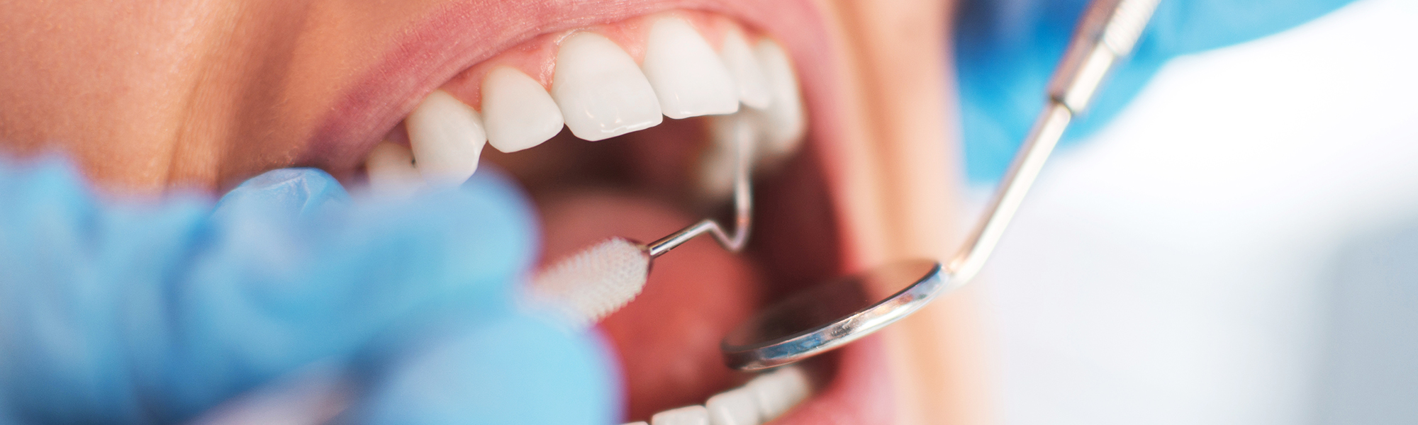 Dental Crowns vs. Fillings: Which Treatment Is Right for You?