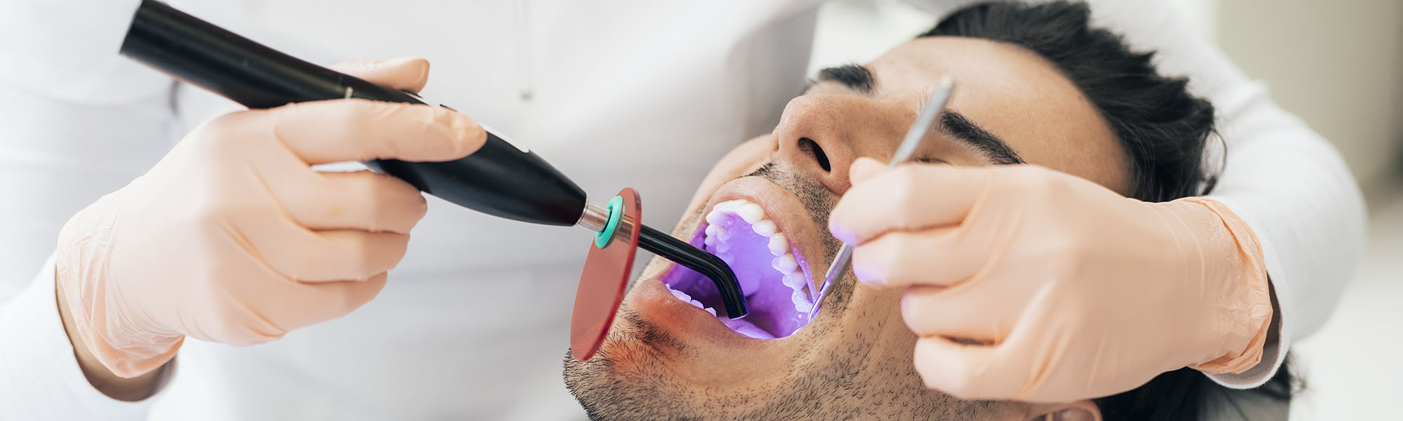 Composite Fillings Carson CA