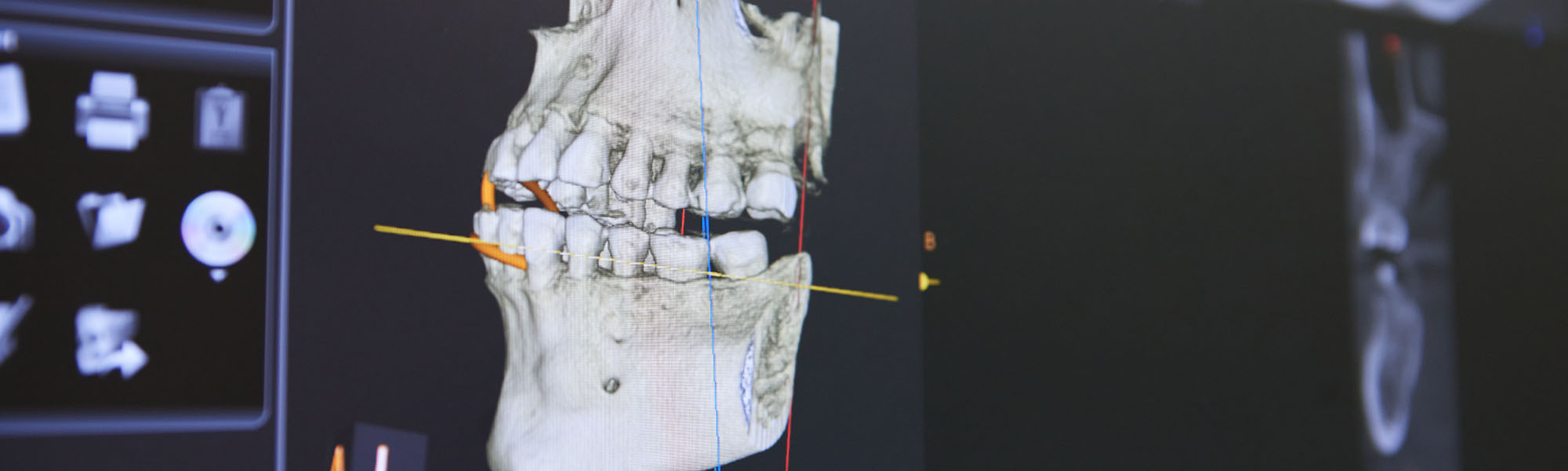 Digital X-rays Carson CA