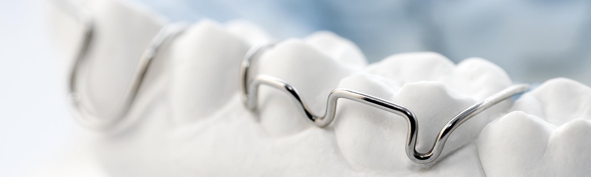 Retainers in Carson CA