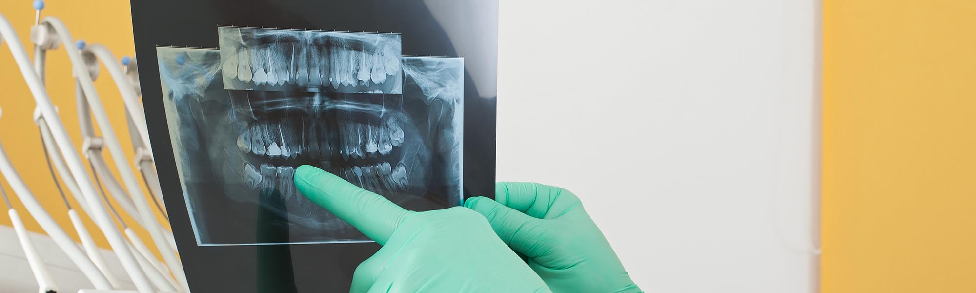 3D Imaging Technology Advantages in Carson CA