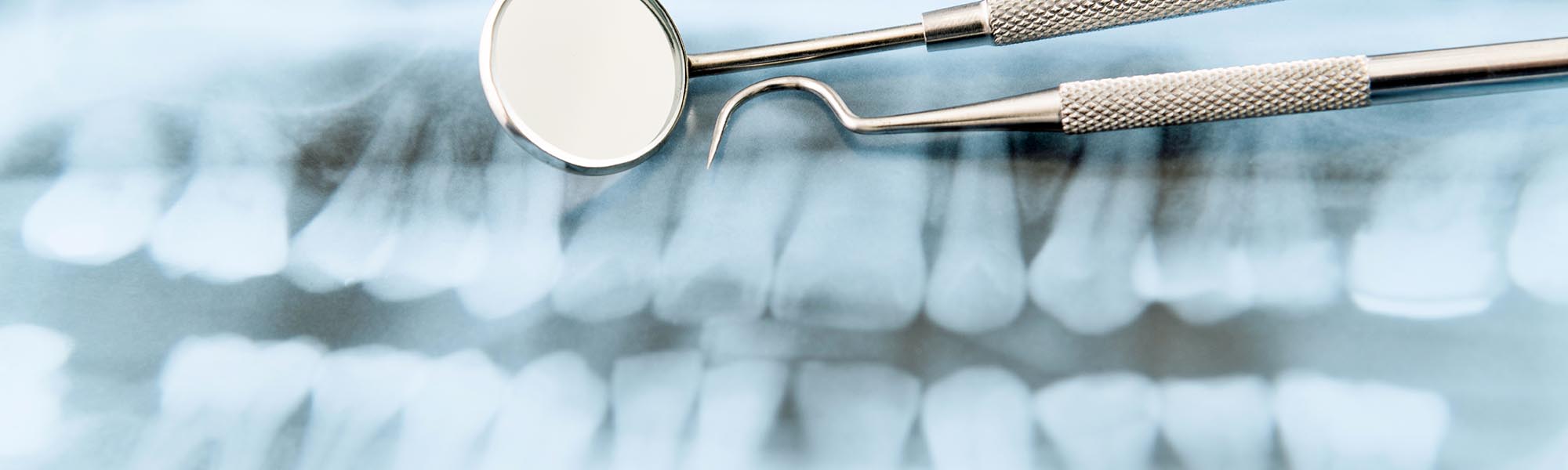 3D Imaging Technology Used in Carson CA
