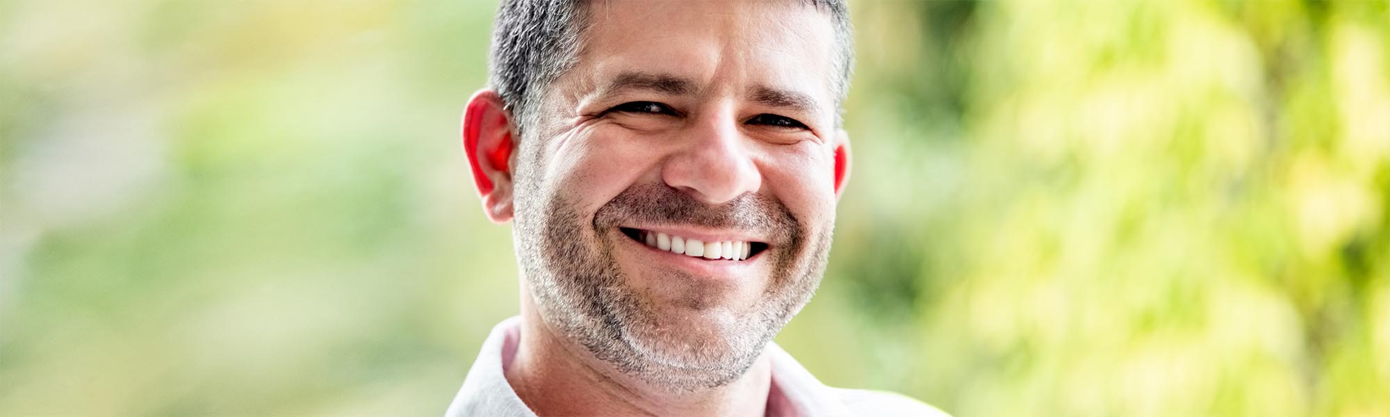 All on 4 Implants Dentist Carson CA