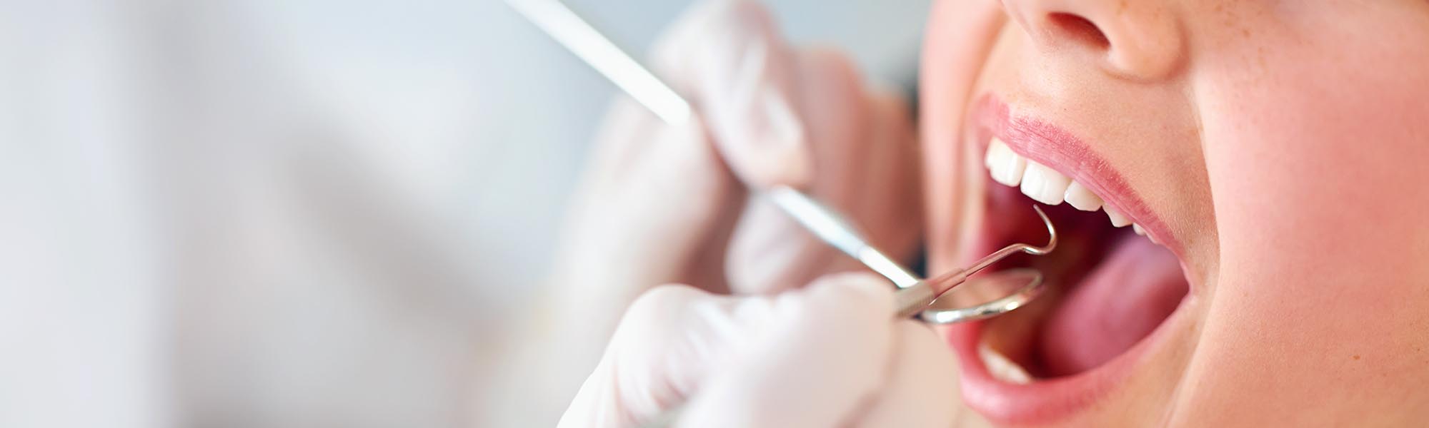 Cleaning and Prevention Treatments in Carson CA