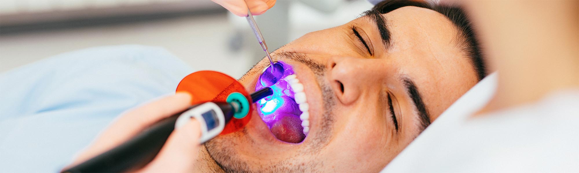 Composite Fillings in Carson CA