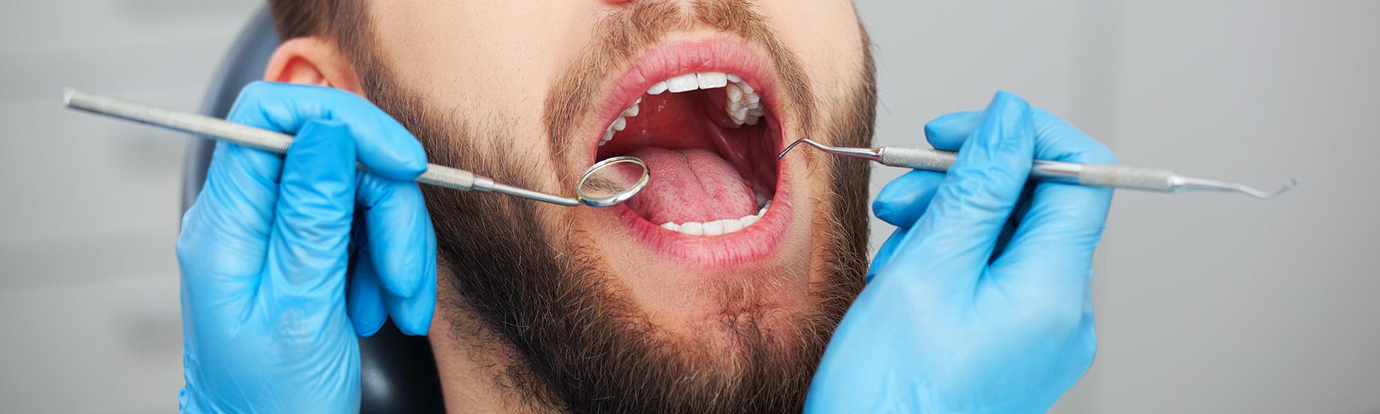 Deep Dental Cleanings Near Me Carson CA
