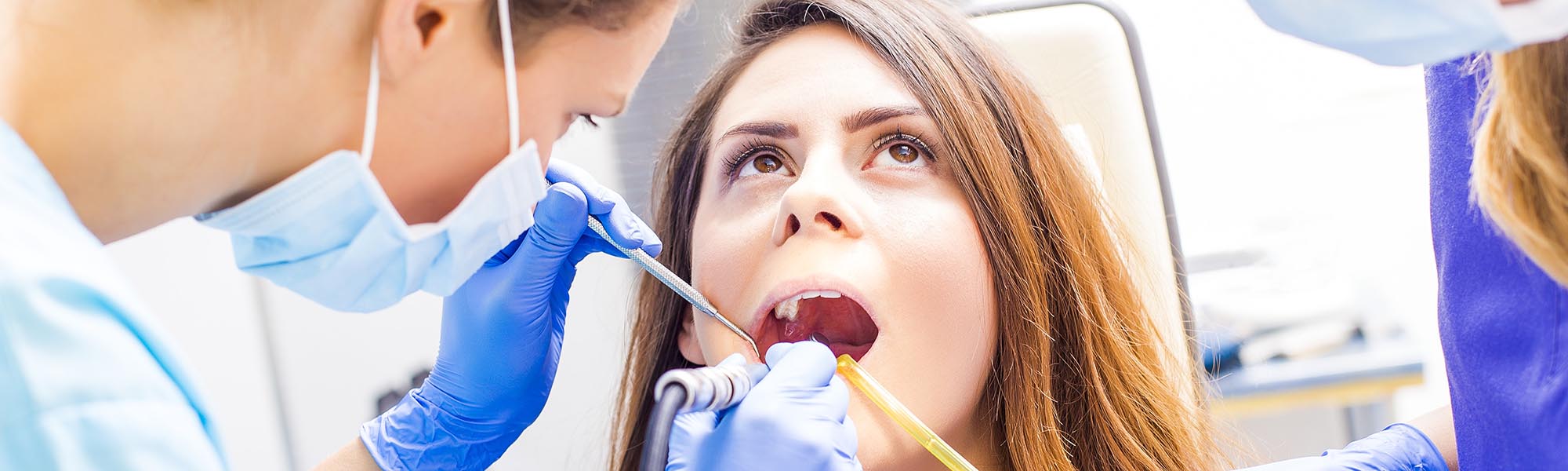 Dental Bonding Benefits Carson CA