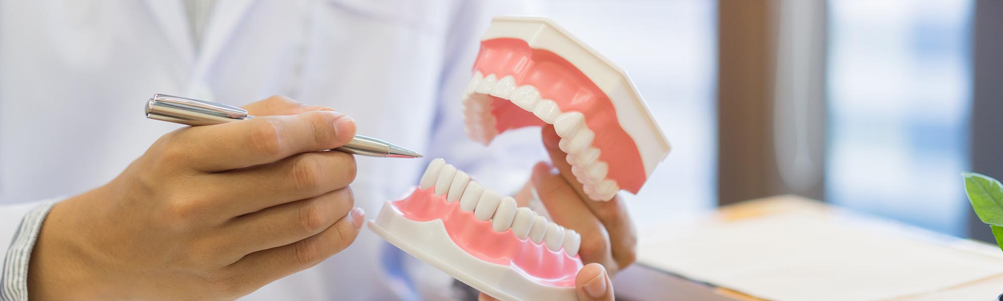 Dental Bonding Dentist Carson CA