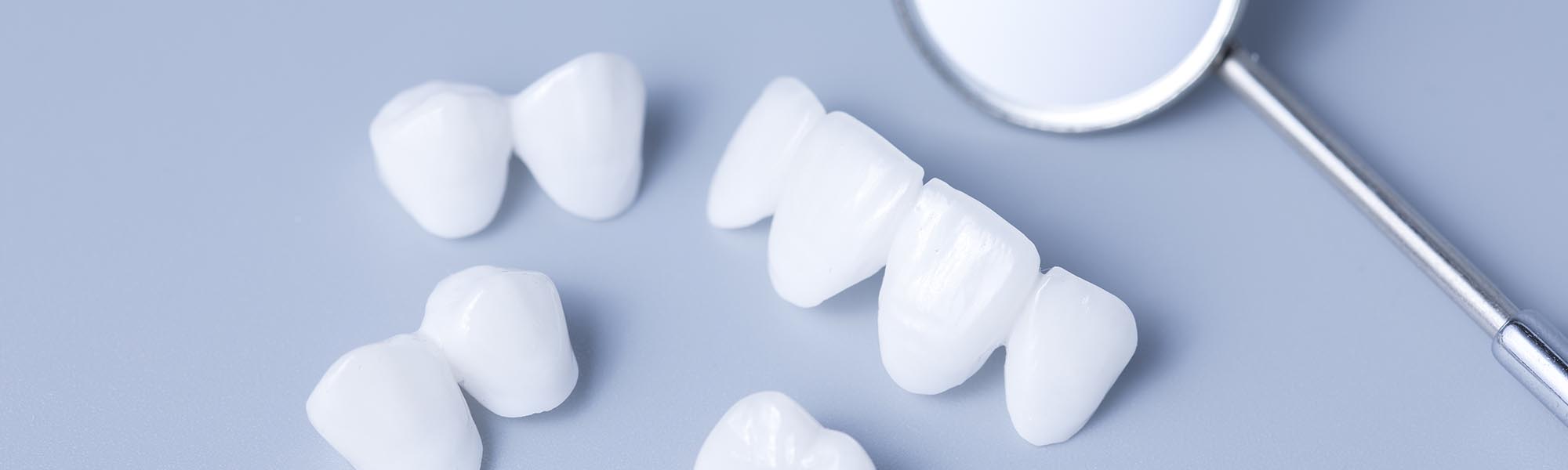 Dental Crowns Dentist in Carson CA