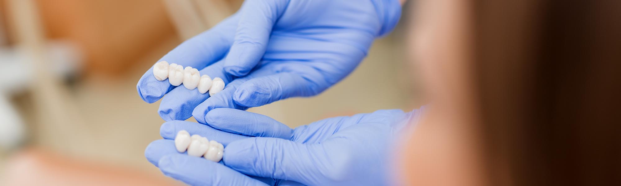 Dental Crowns Dentists in Carson CA