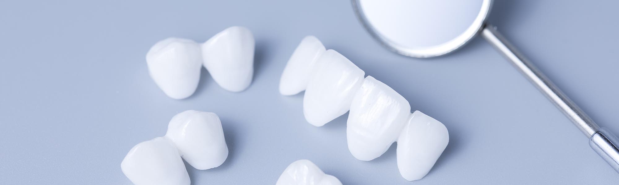 Porcelain Crowns Carson CA
