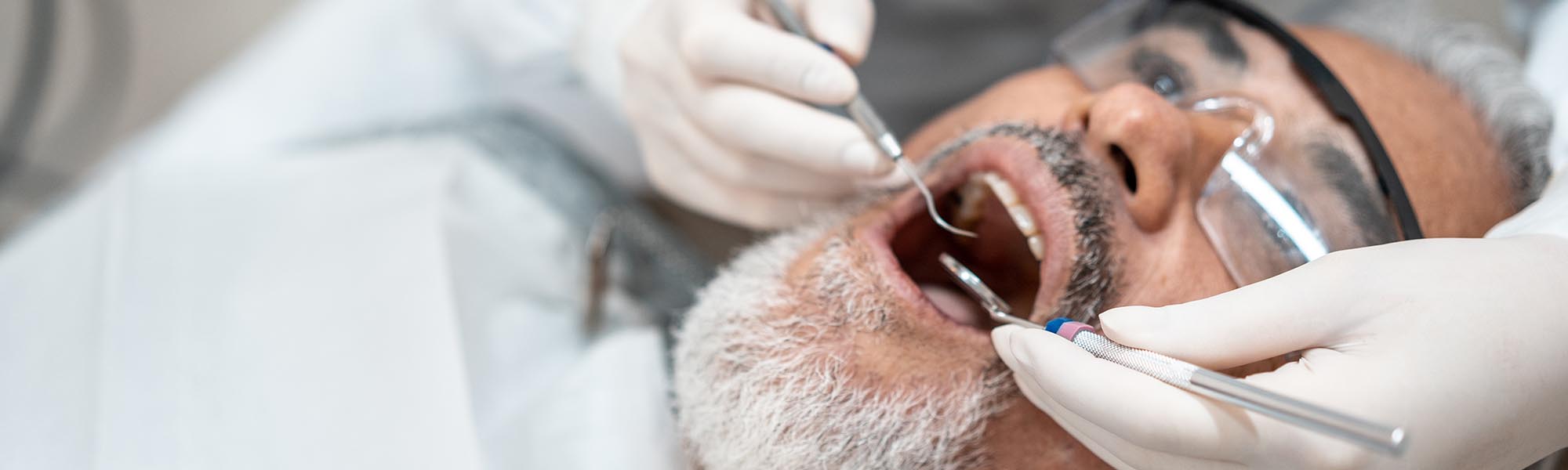 Restorative Inlays & Onlays Carson CA