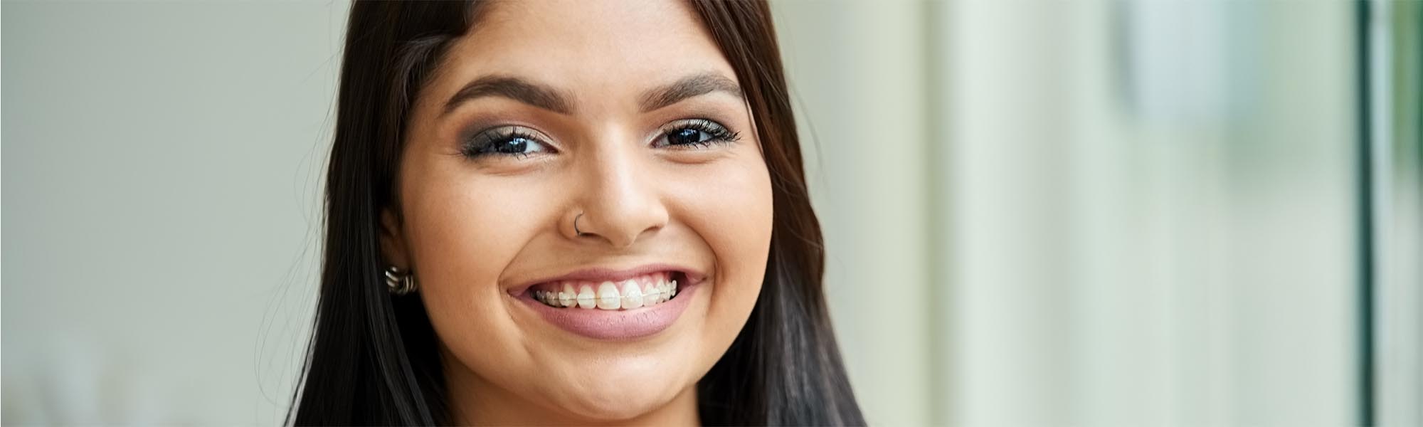 Porcelain Ceramic Braces in Carson CA