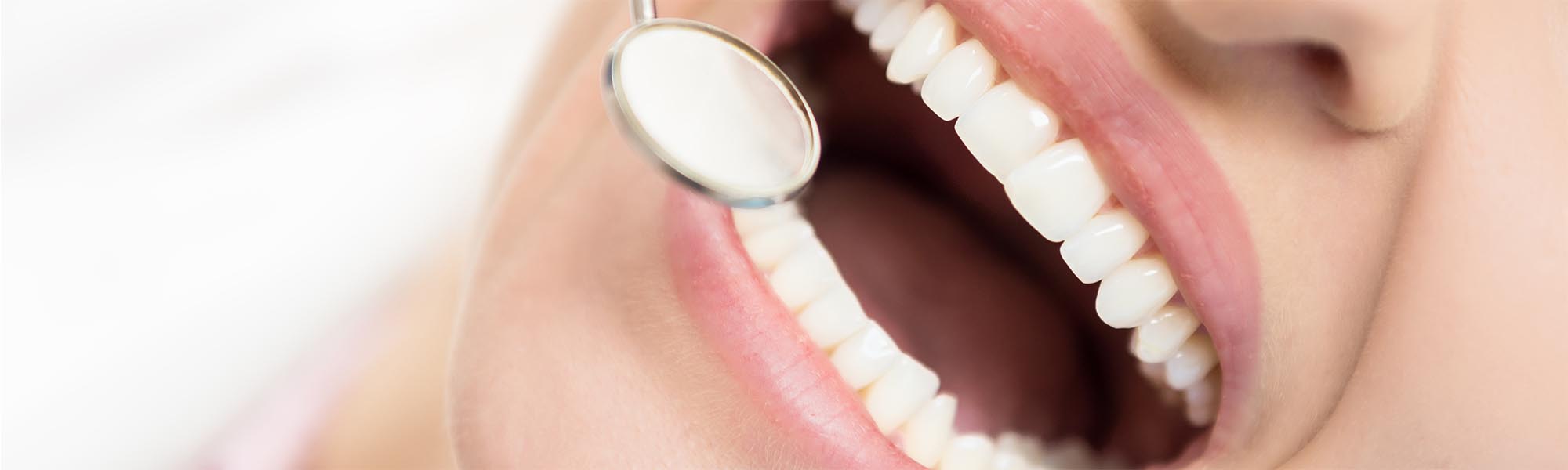 Soft Tissue Grafting  Carson CA