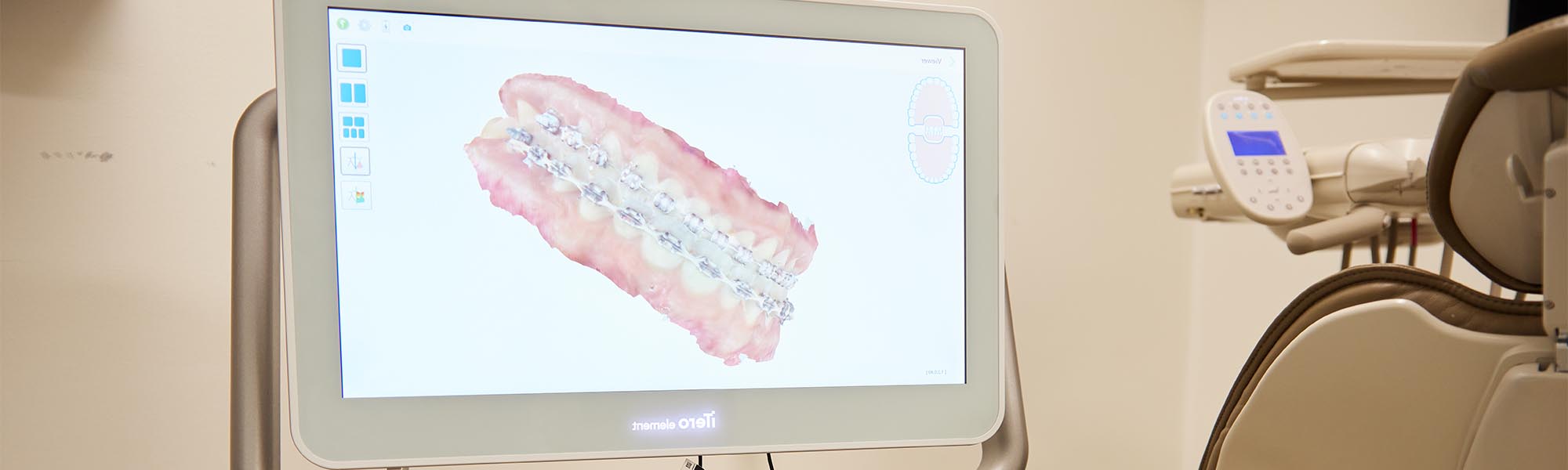 Innovative Dental Technology Carson CA