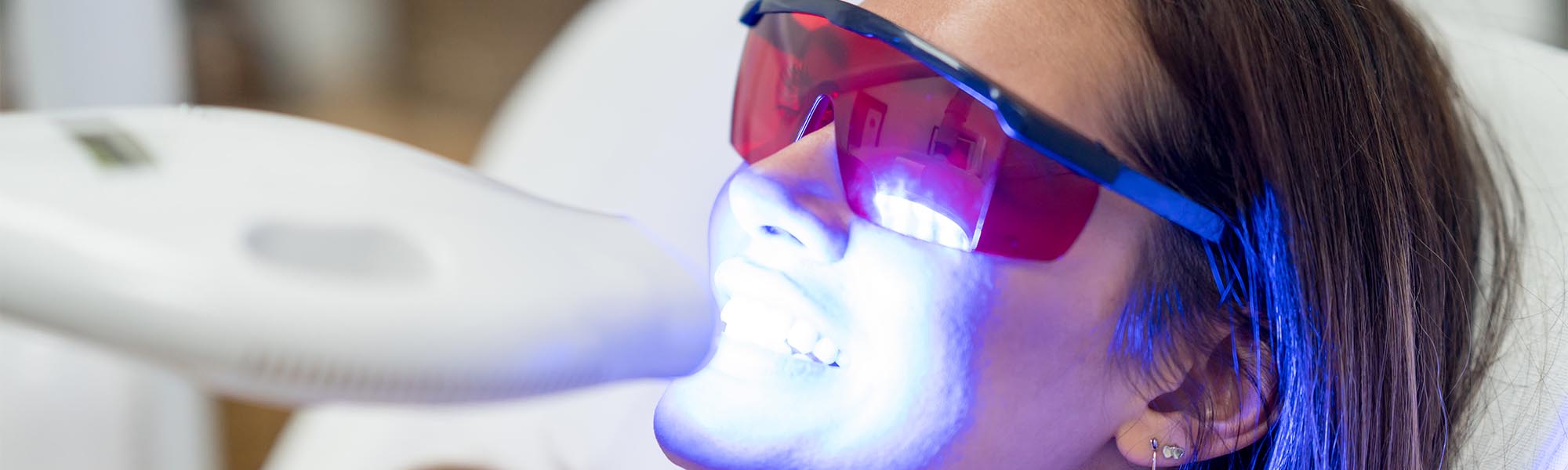 Teeth Whitening in Carson CA