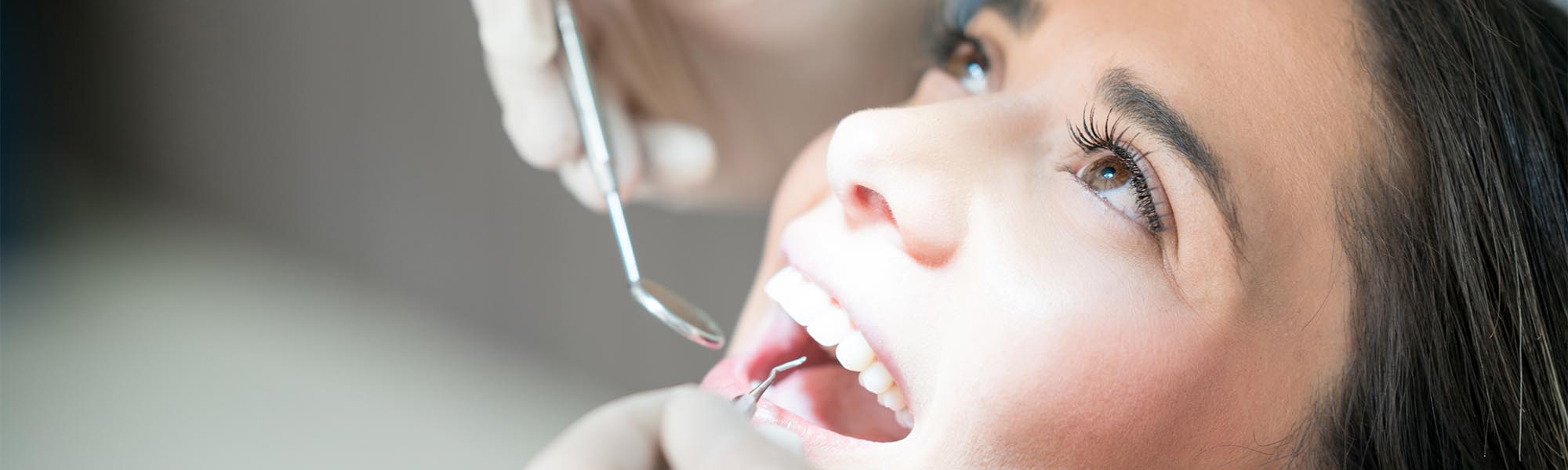 Porcelain Veneers Carson CA